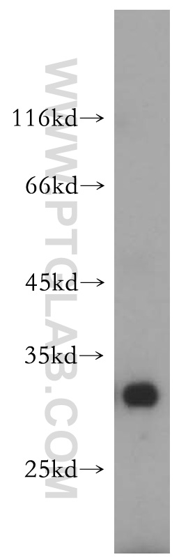 WB analysis of HepG2 using 17994-1-AP