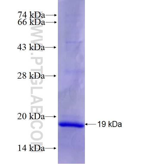 RBMXL2 fusion protein Ag27912 SDS-PAGE RBMXL2 fusion protein Ag27912 SDS-PAGE