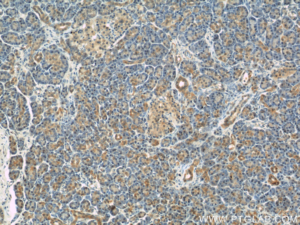 IHC staining of human pancreas using 22683-1-AP