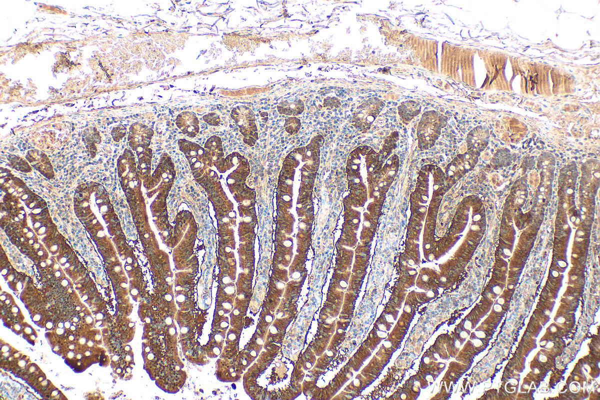 IHC staining of human small intestine using 31527-1-AP