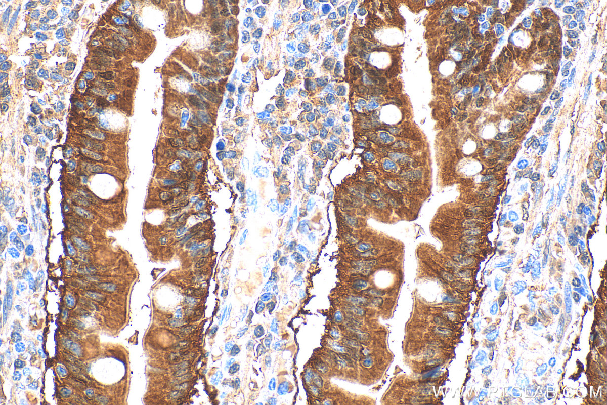 IHC staining of human small intestine using 31527-1-AP
