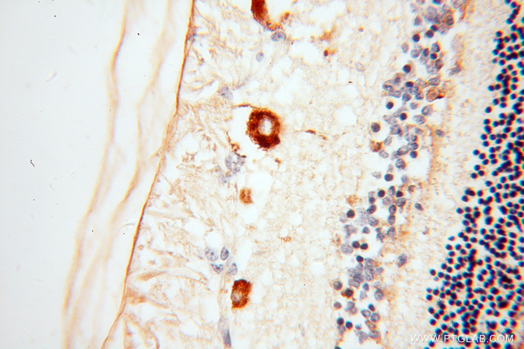 IHC staining of human eye using 14352-1-AP