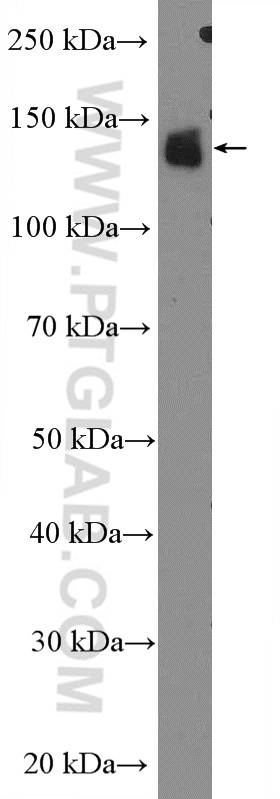 WB analysis of mouse eye using 14352-1-AP