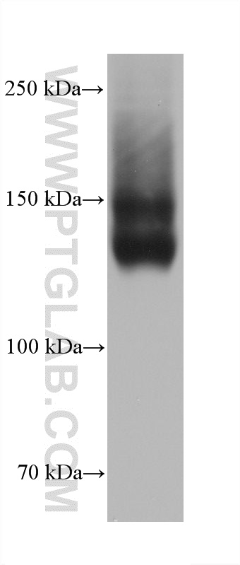 WB analysis of rabbit retina using 60921-3-Ig WB analysis of rabbit retina using 60921-3-Ig