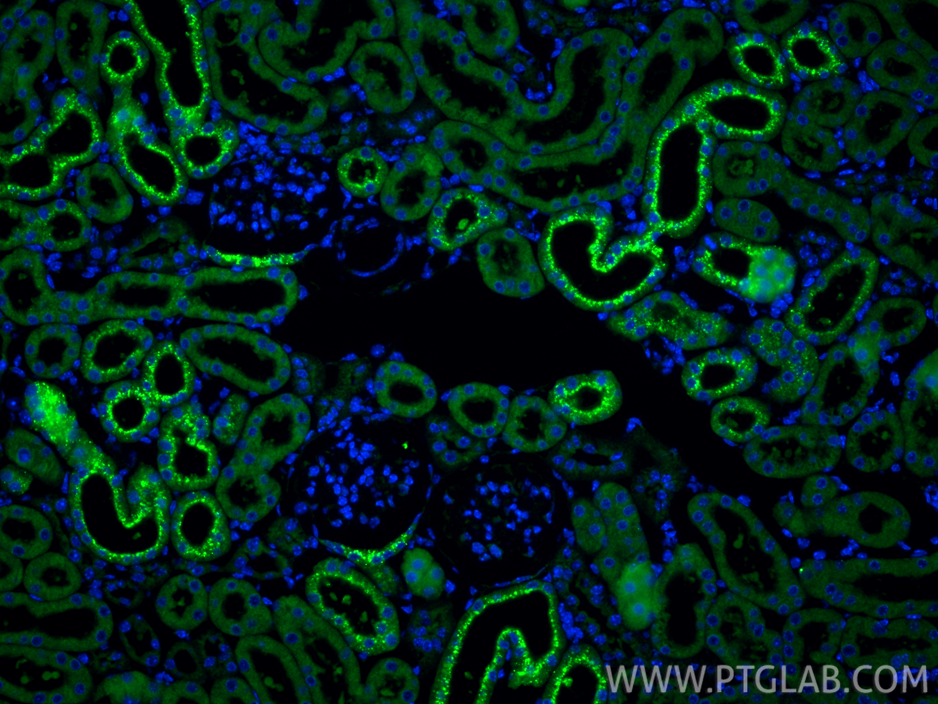 IF Staining of mouse kidney using 11774-1-AP IF Staining of mouse kidney using 11774-1-AP