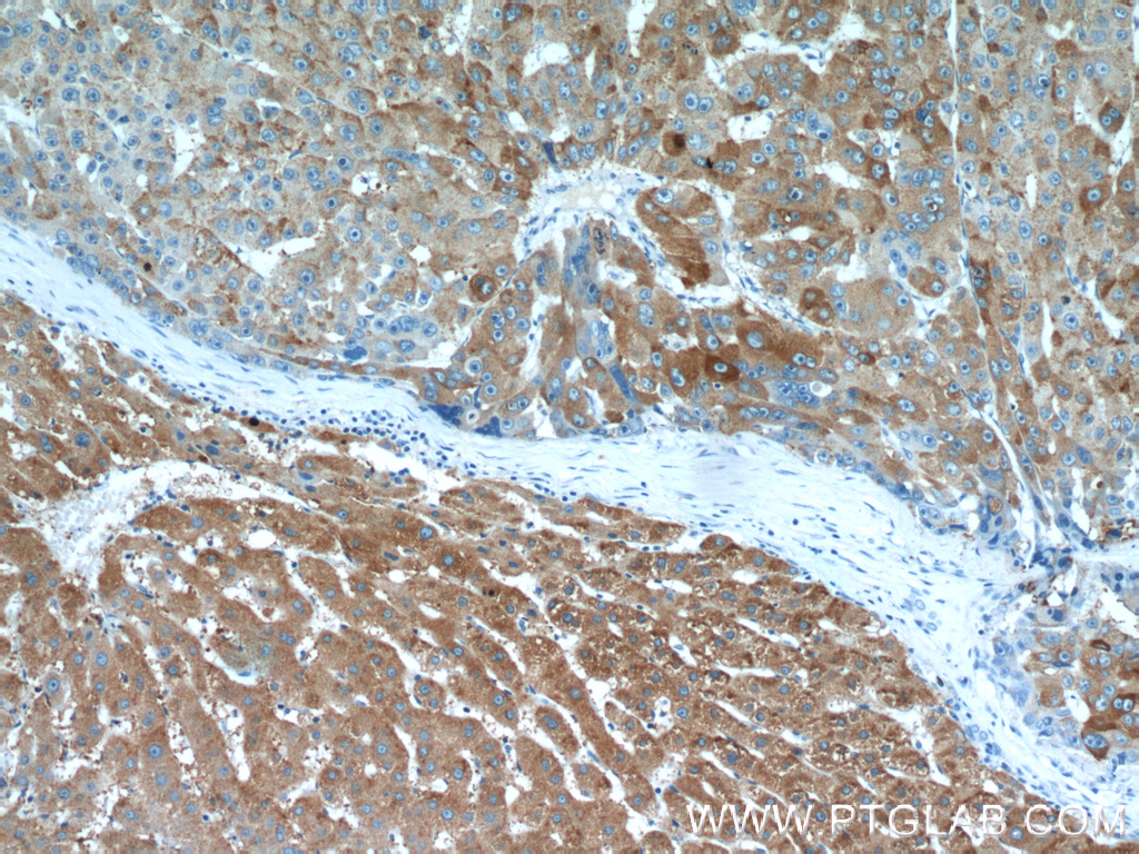 RBP4 Polyclonal antibody