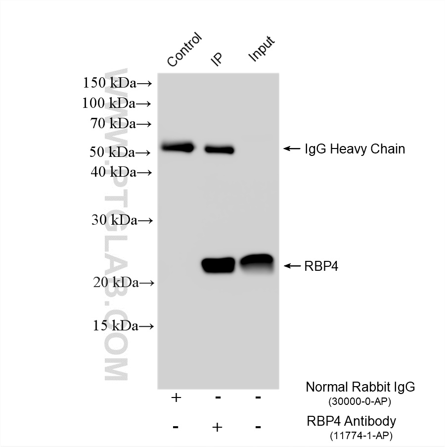 IP experiment of HepG2 using 11774-1-AP