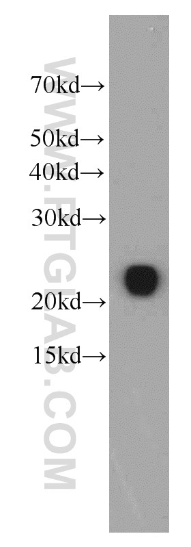 WB analysis of human plasma using 66104-1-Ig (same clone as 66104-1-PBS)