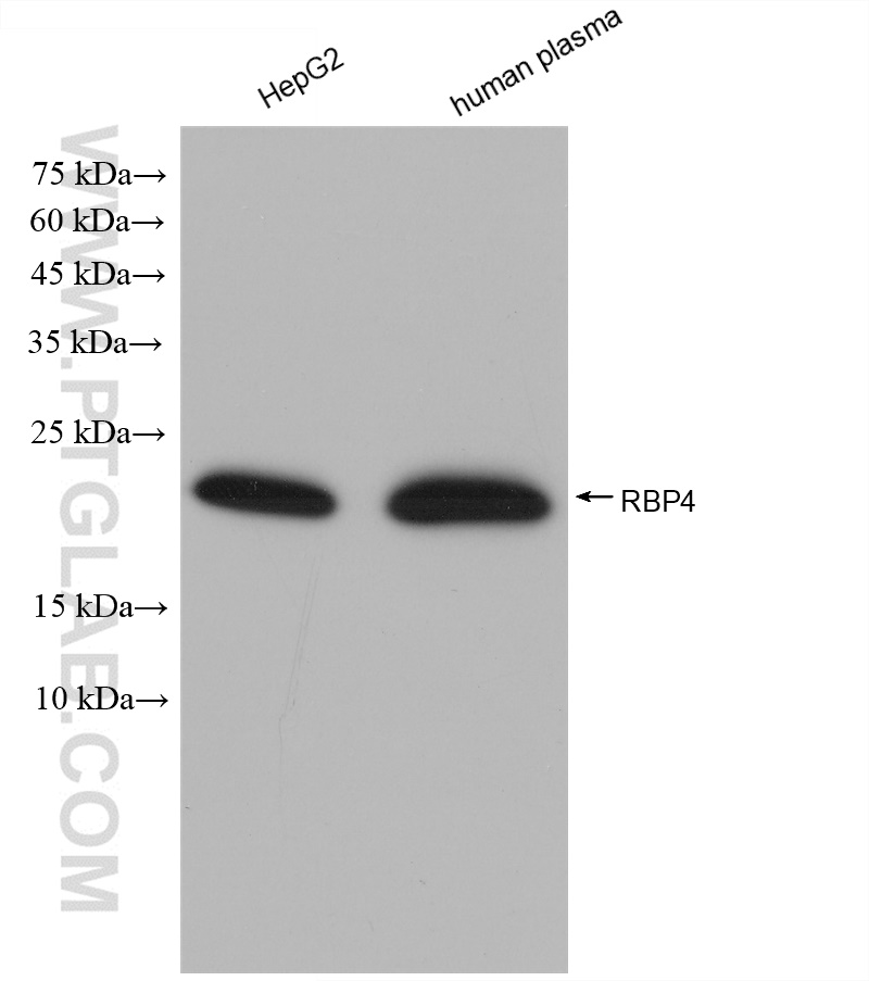 WB analysis using 82934-1-RR