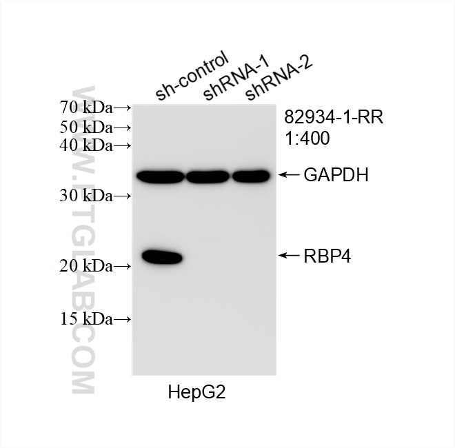 WB analysis of HepG2 using 82934-1-RR (same clone as 82934-1-PBS)