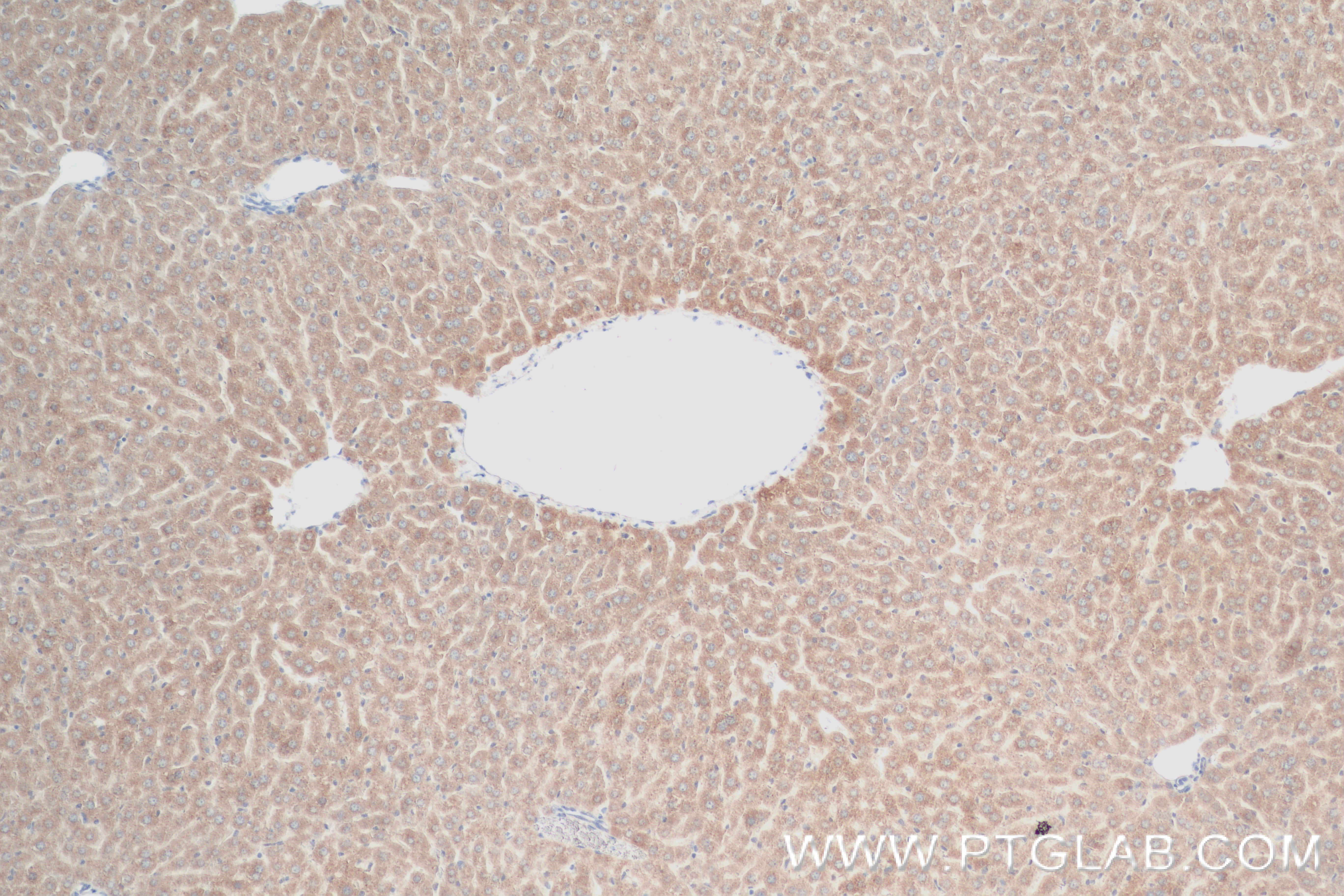 IHC staining of mouse liver using 84503-4-RR