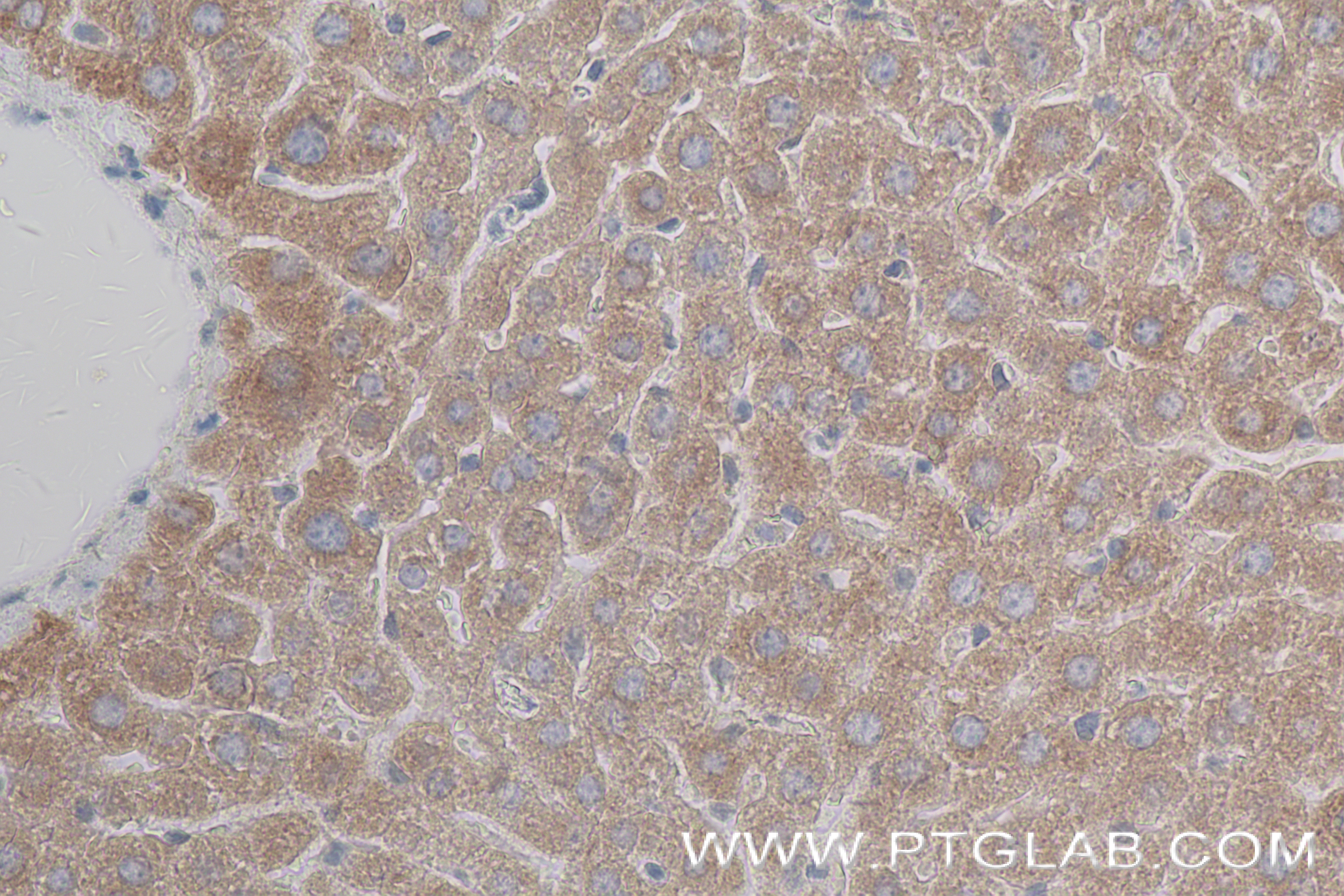 IHC staining of mouse liver using 84503-4-RR