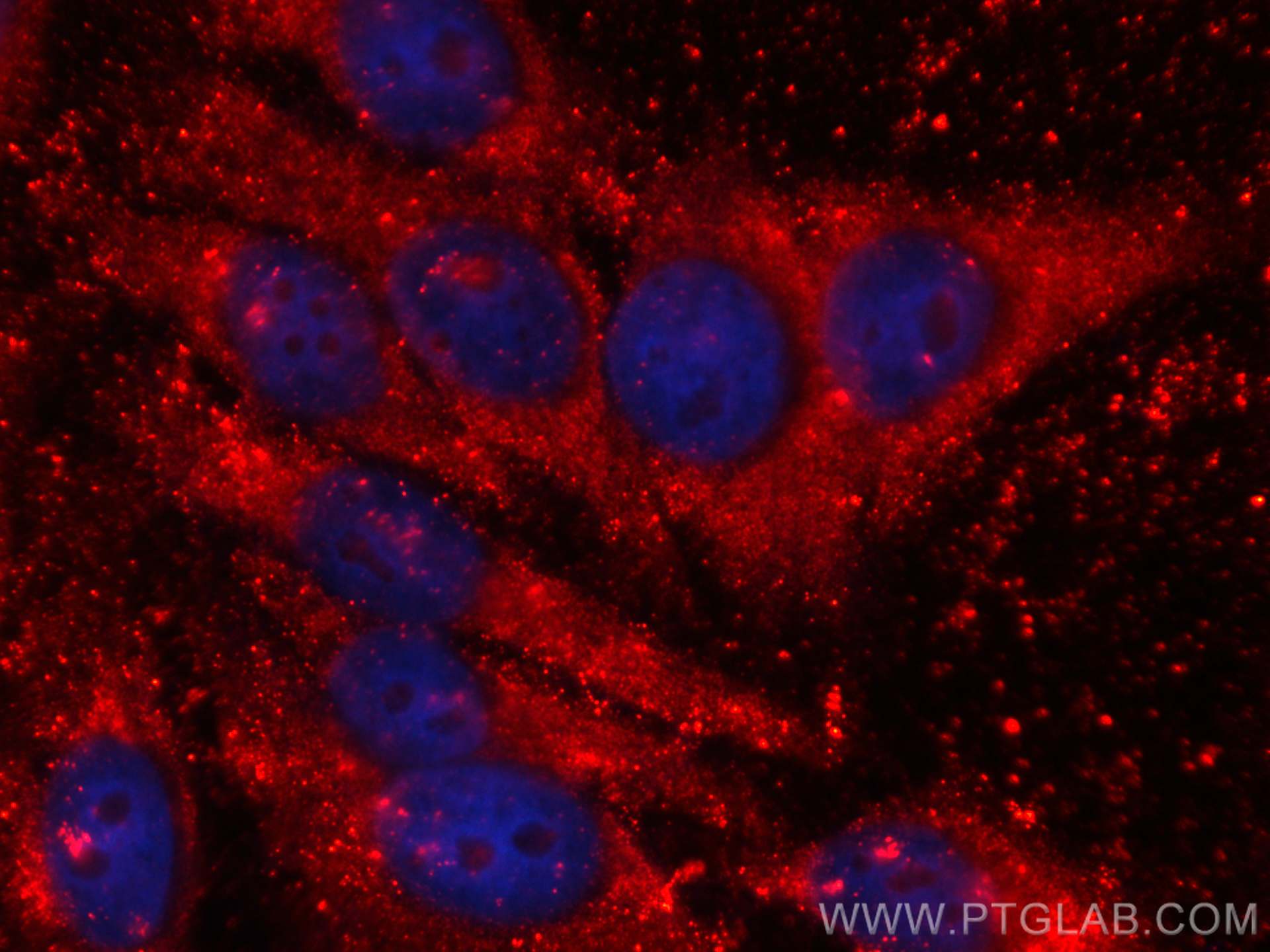 IF Staining of HepG2 using CL594-66104