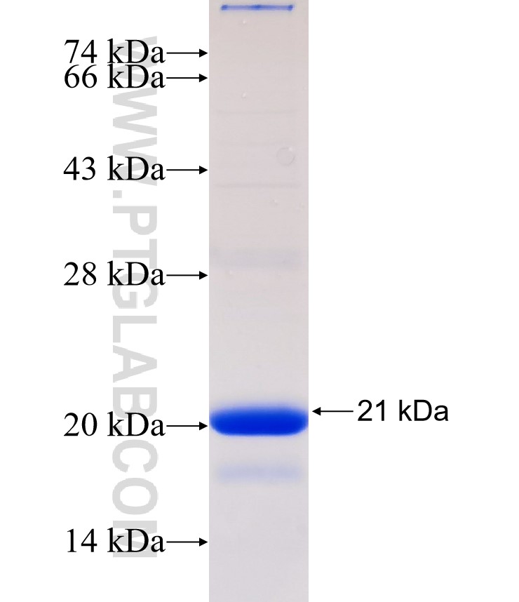 RBPJ fusion protein Ag32636 SDS-PAGE RBPJ fusion protein Ag32636 SDS-PAGE
