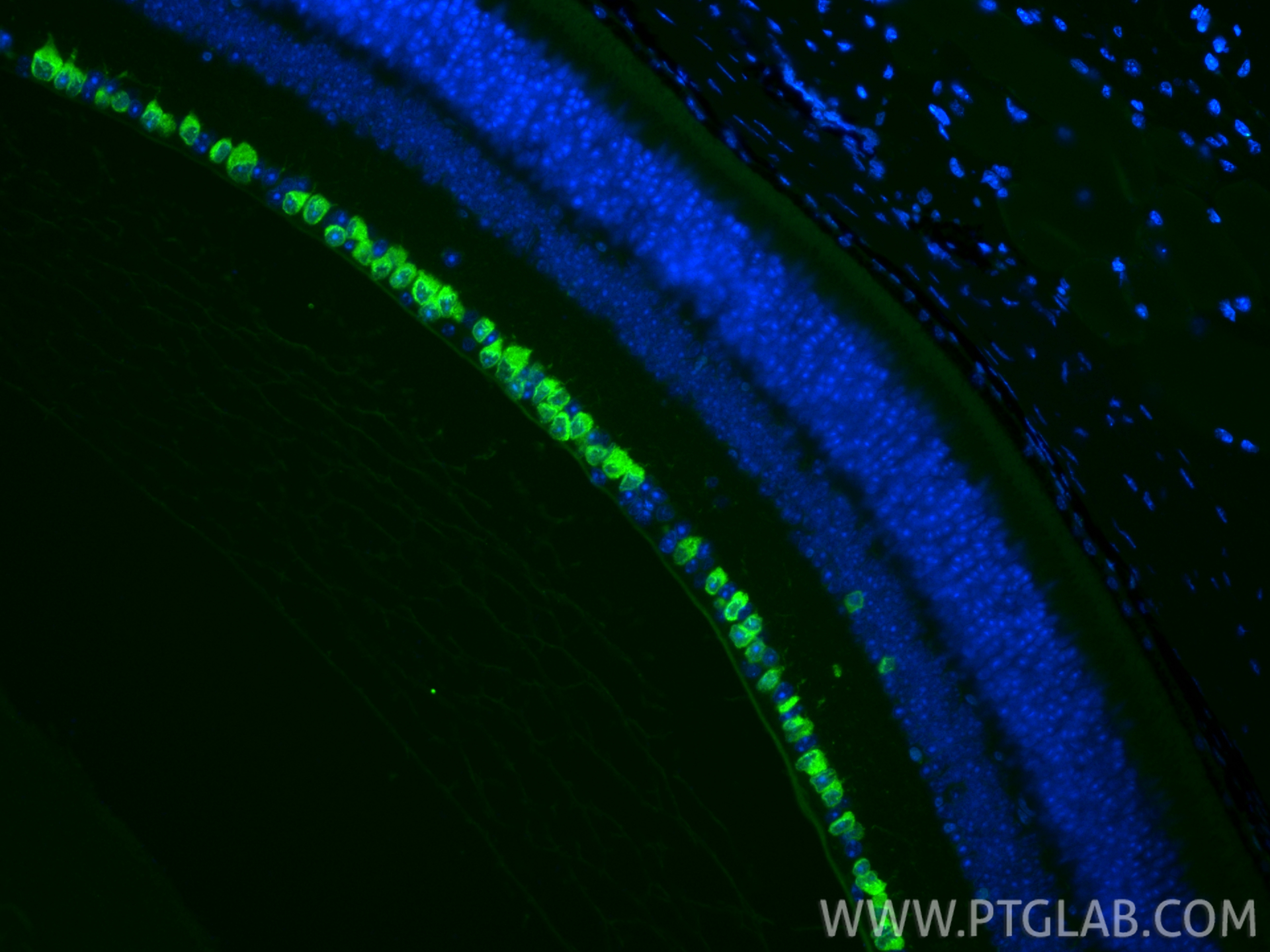 IF Staining of mouse eye using RMX00116 IF Staining of mouse eye using RMX00116