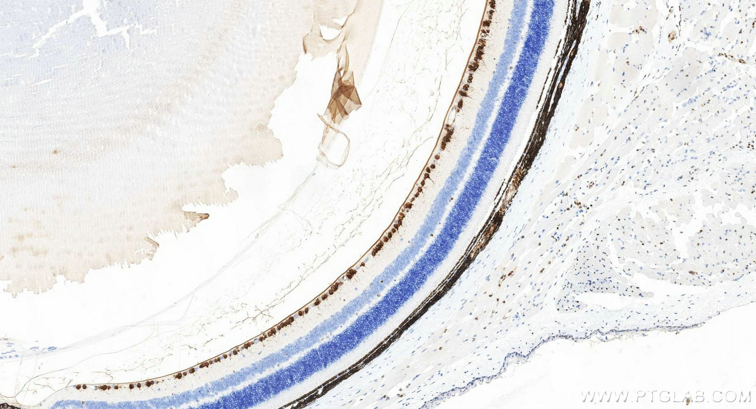 IHC staining of mouse eye using RMX00116 IHC staining of mouse eye using RMX00116