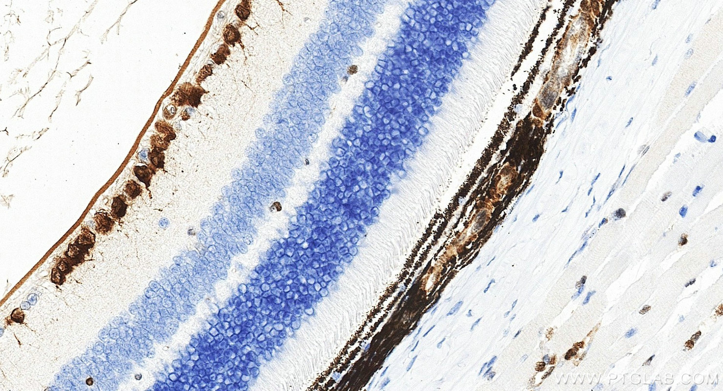 IHC staining of mouse eye using RMX00116 IHC staining of mouse eye using RMX00116