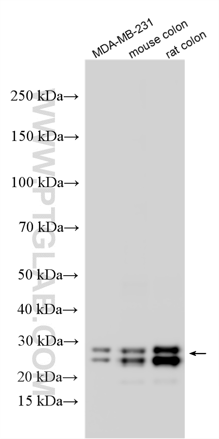 WB analysis using RMX00116 WB analysis using RMX00116