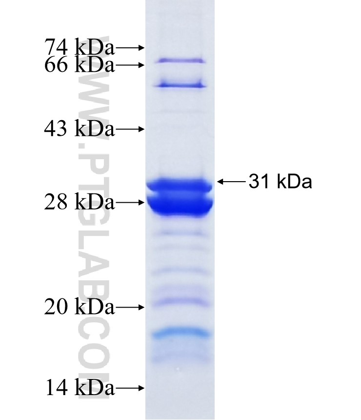 RBPMS fusion protein Ag7959 SDS-PAGE RBPMS fusion protein Ag7959 SDS-PAGE