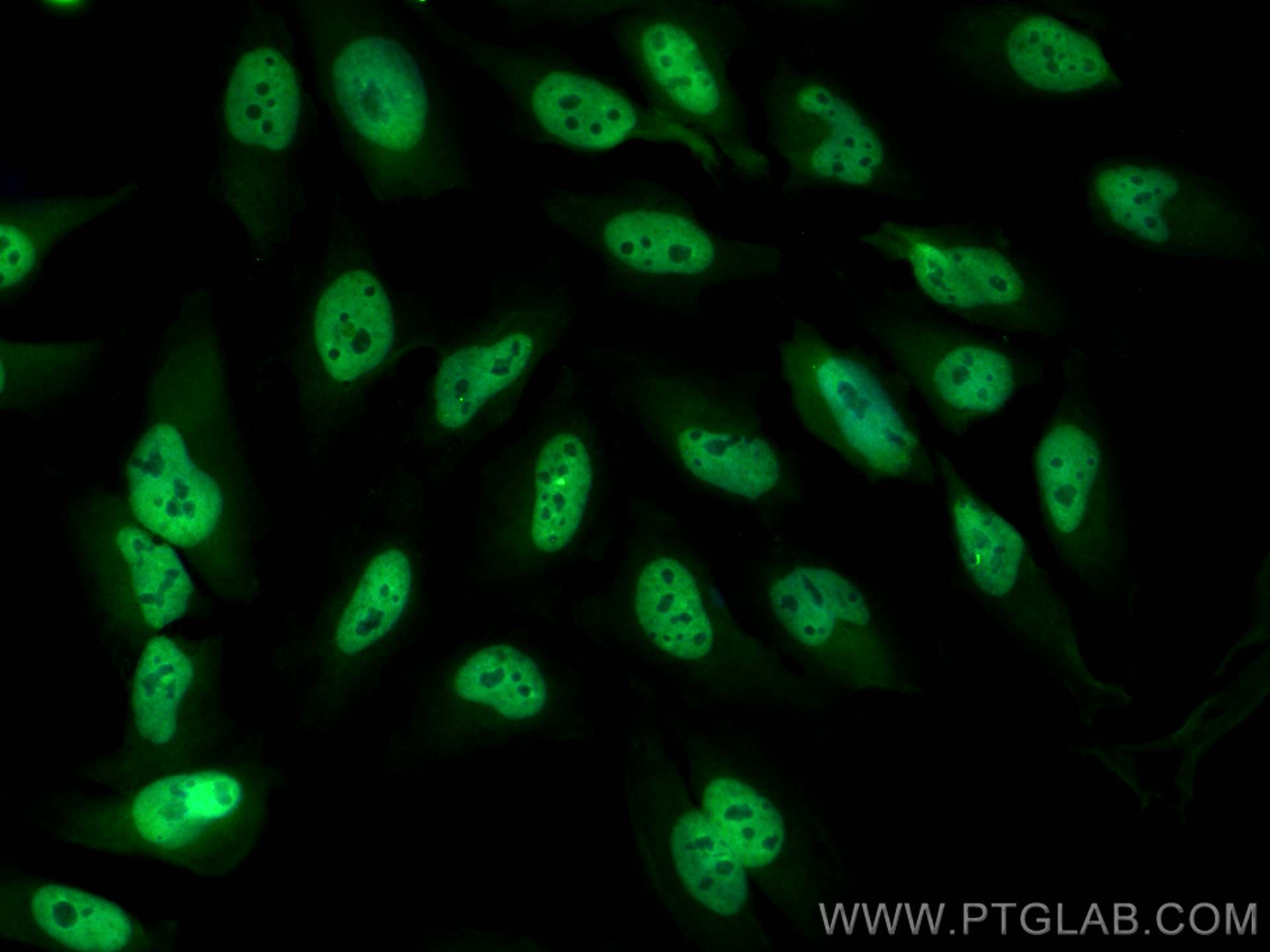 IF Staining of HeLa using CL488-66716