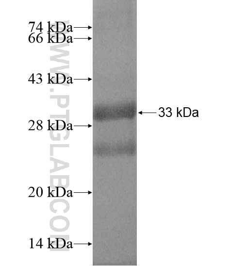 RC3H2 fusion protein Ag20305 SDS-PAGE RC3H2 fusion protein Ag20305 SDS-PAGE