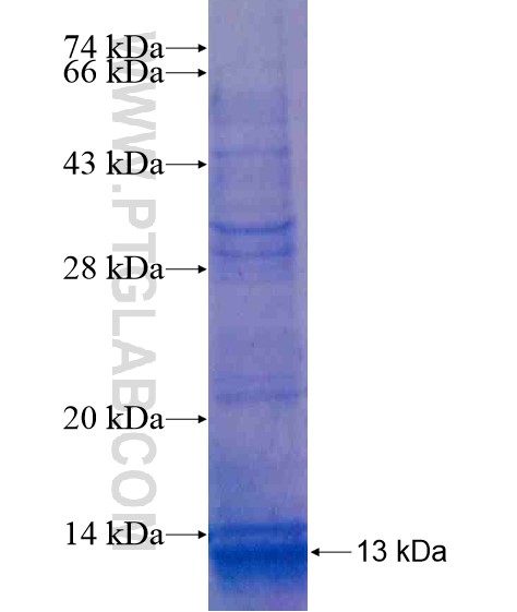 RC3H2 fusion protein Ag20408 SDS-PAGE RC3H2 fusion protein Ag20408 SDS-PAGE