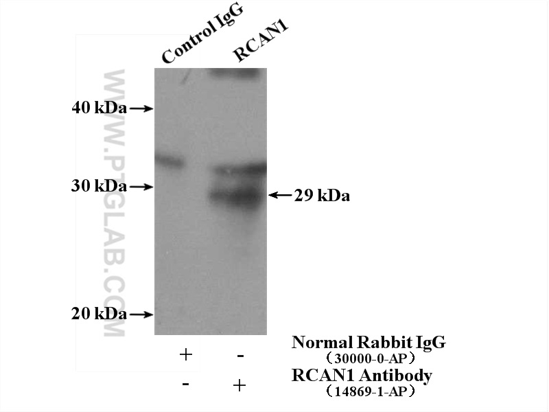 IP experiment of mouse brain using 14869-1-AP