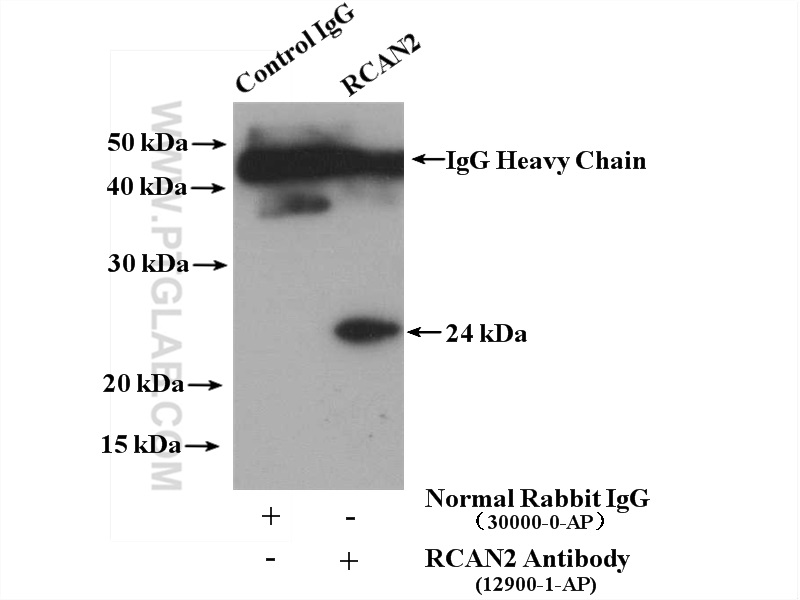 IP experiment of mouse brain using 12900-1-AP (same clone as 12900-1-PBS)