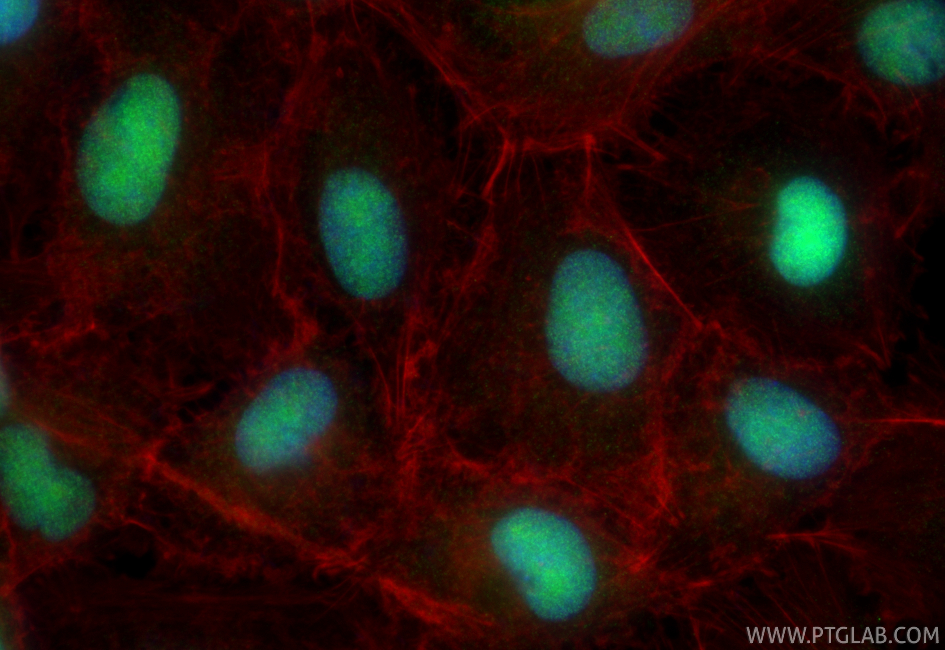 IF Staining of A549 using 22142-1-AP