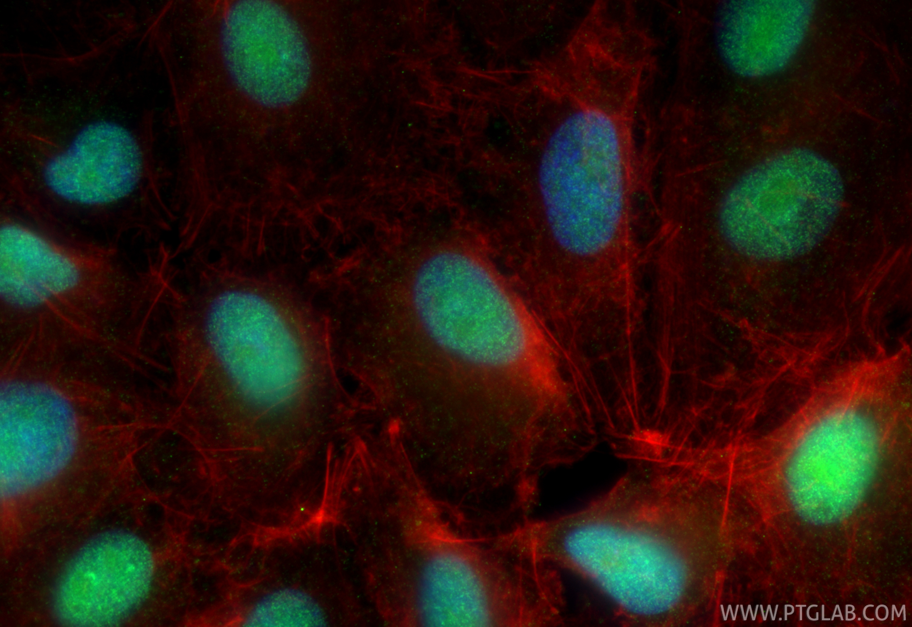 IF Staining of A549 using 22142-1-AP IF Staining of A549 using 22142-1-AP