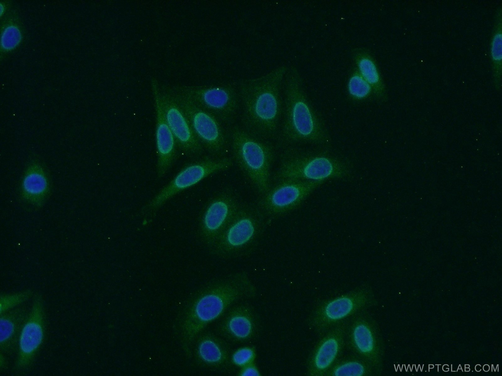 IF Staining of HepG2 using 22335-1-AP