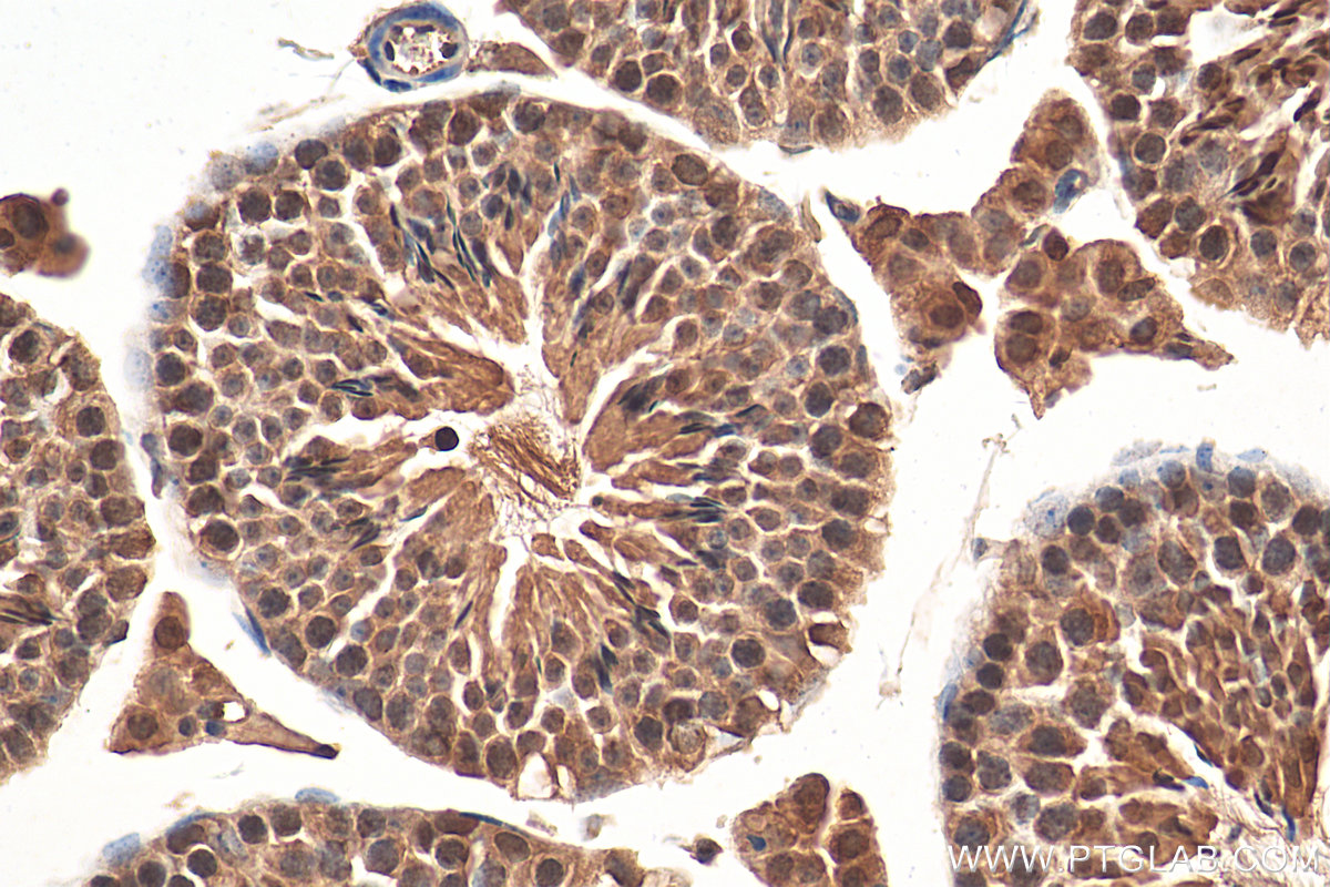 IHC staining of mouse testis using 22335-1-AP