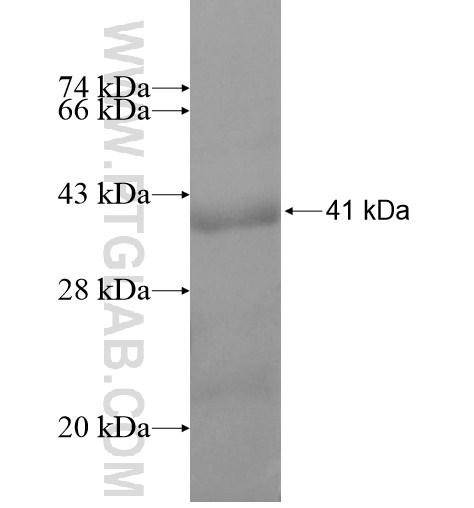 RCC2 fusion protein Ag10251 SDS-PAGE