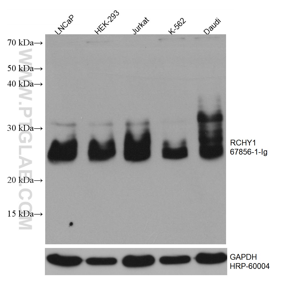 WB analysis using 67856-1-Ig