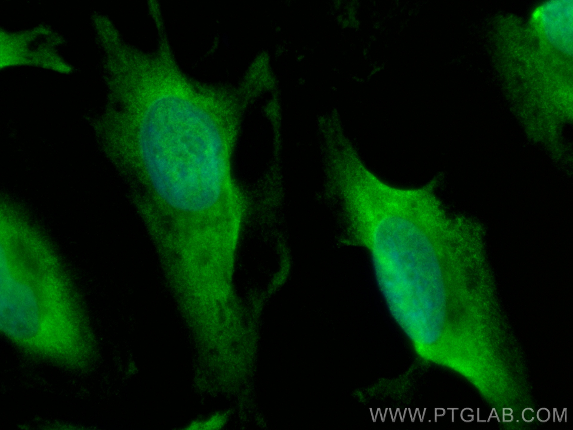 IF Staining of HeLa using CL488-67856