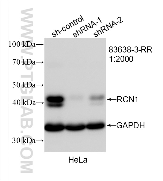 WB analysis of HeLa using 83638-3-RR (same clone as 83638-3-PBS)