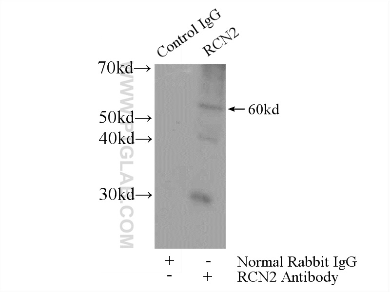 IP experiment of mouse lung using 10193-2-AP