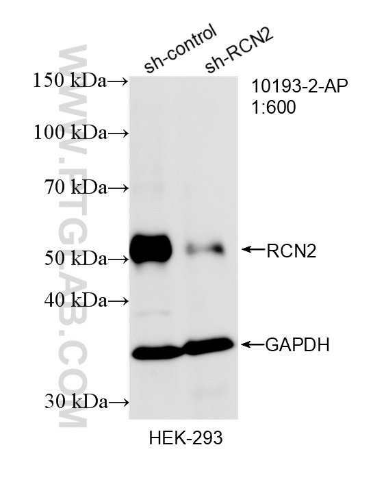 WB analysis of HEK-293 using 10193-2-AP WB analysis of HEK-293 using 10193-2-AP