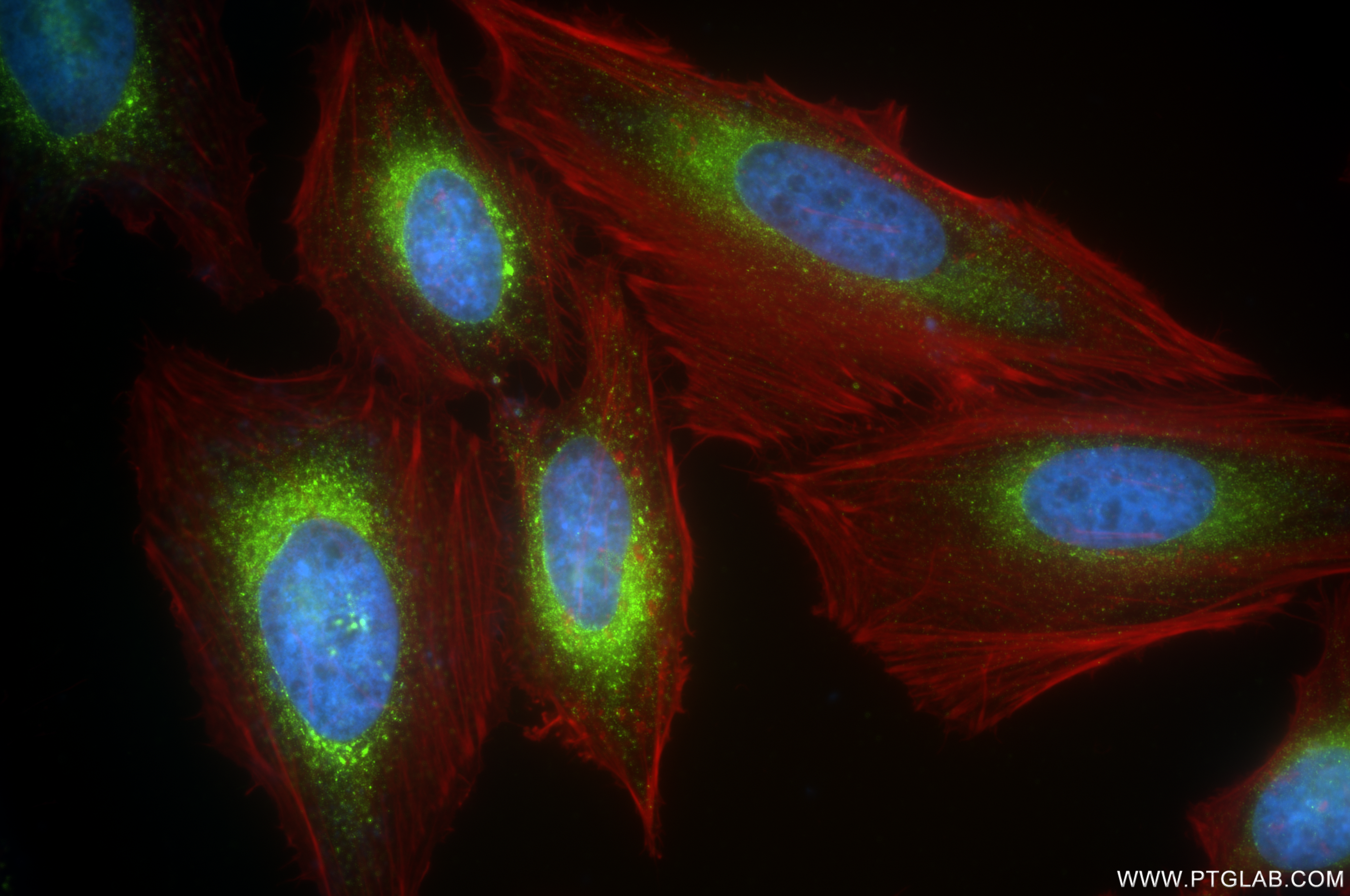 IF Staining of HeLa using 84956-4-RR