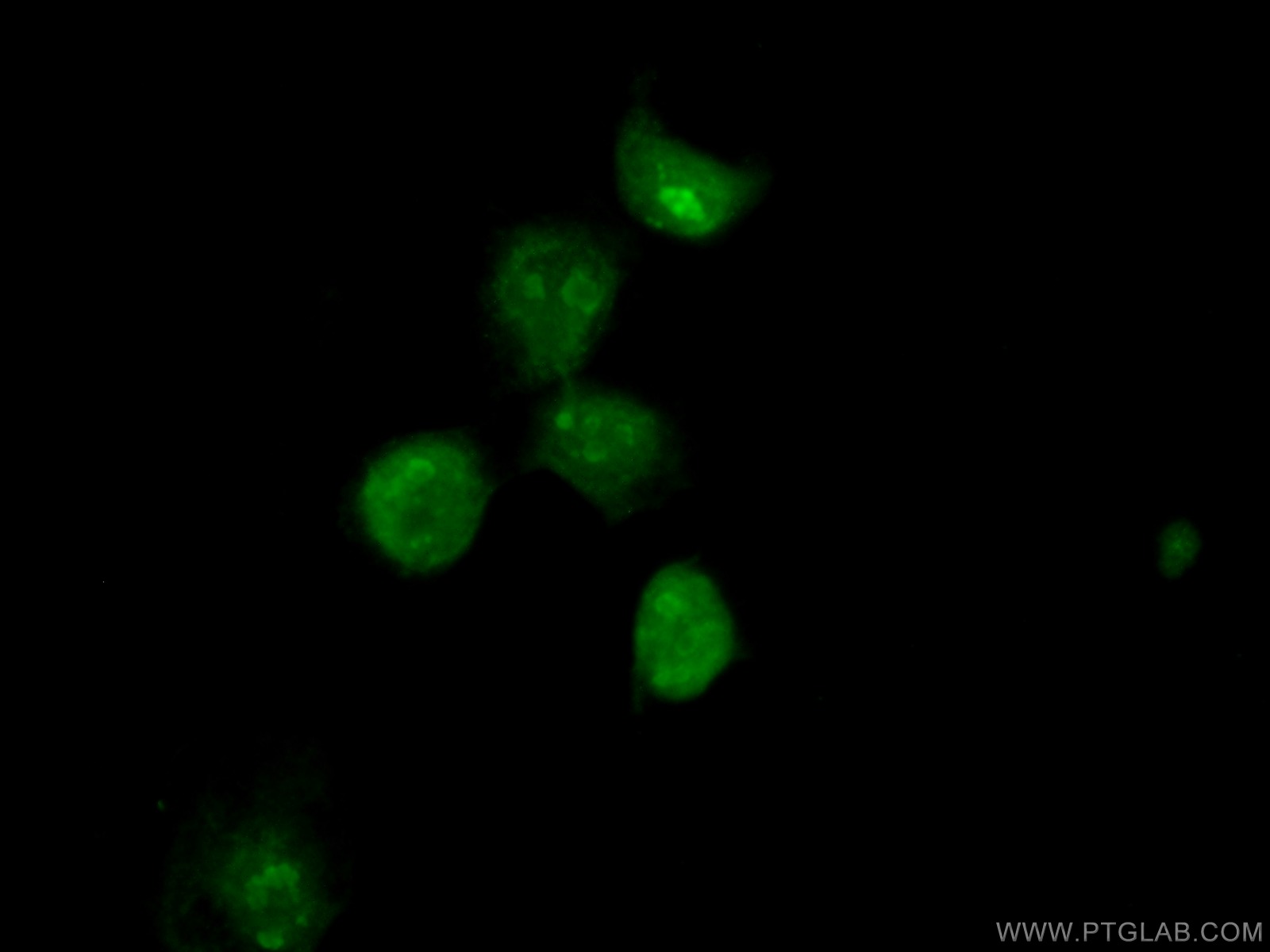 IF Staining of A431 using 55173-1-AP