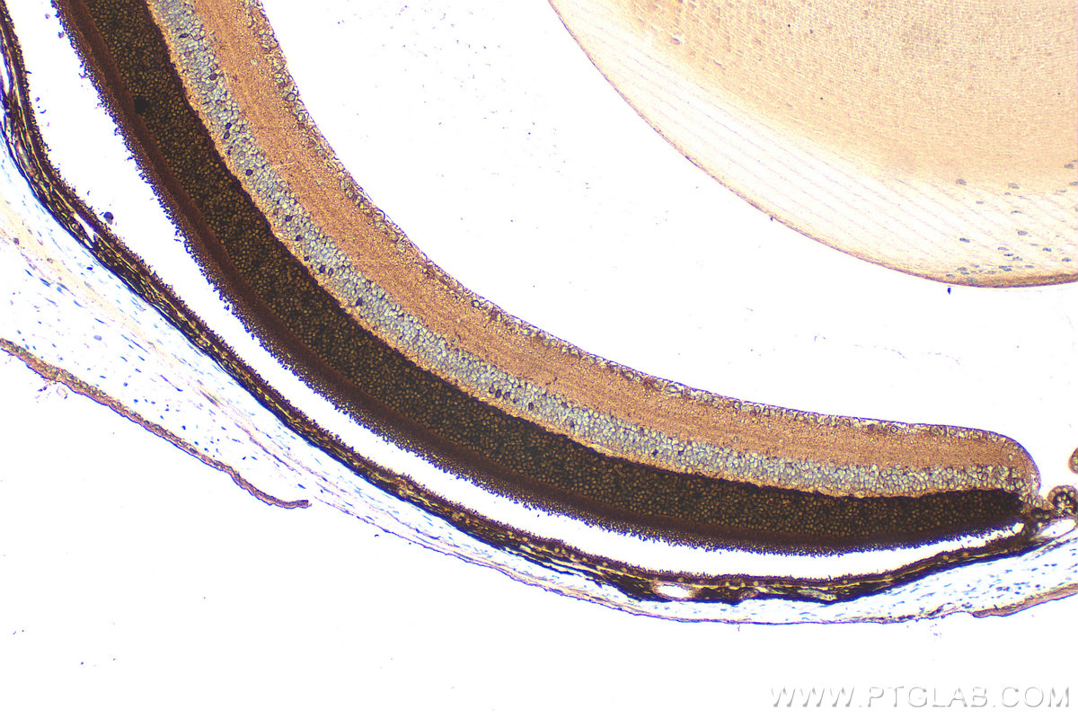 Immunohistochemical analysis of paraffin-embedded mouse eye tissue slide using 10073-1-AP (Recoverin antibody) at dilution of 1:200 (under 10x lens). Heat mediated antigen retrieval with Tris-EDTA buffer (pH 9.0). IHC staining of mouse eye using 10073-1-AP