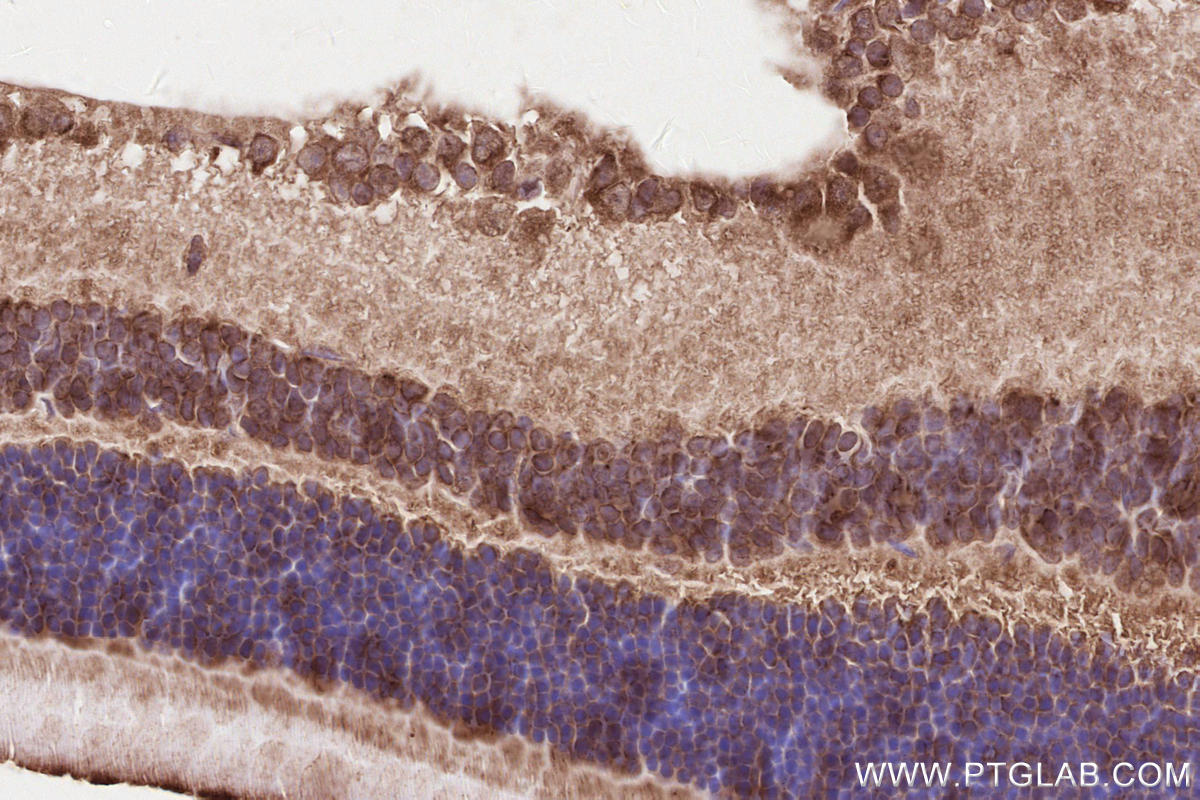 IHC staining of mouse eye using 14855-1-AP