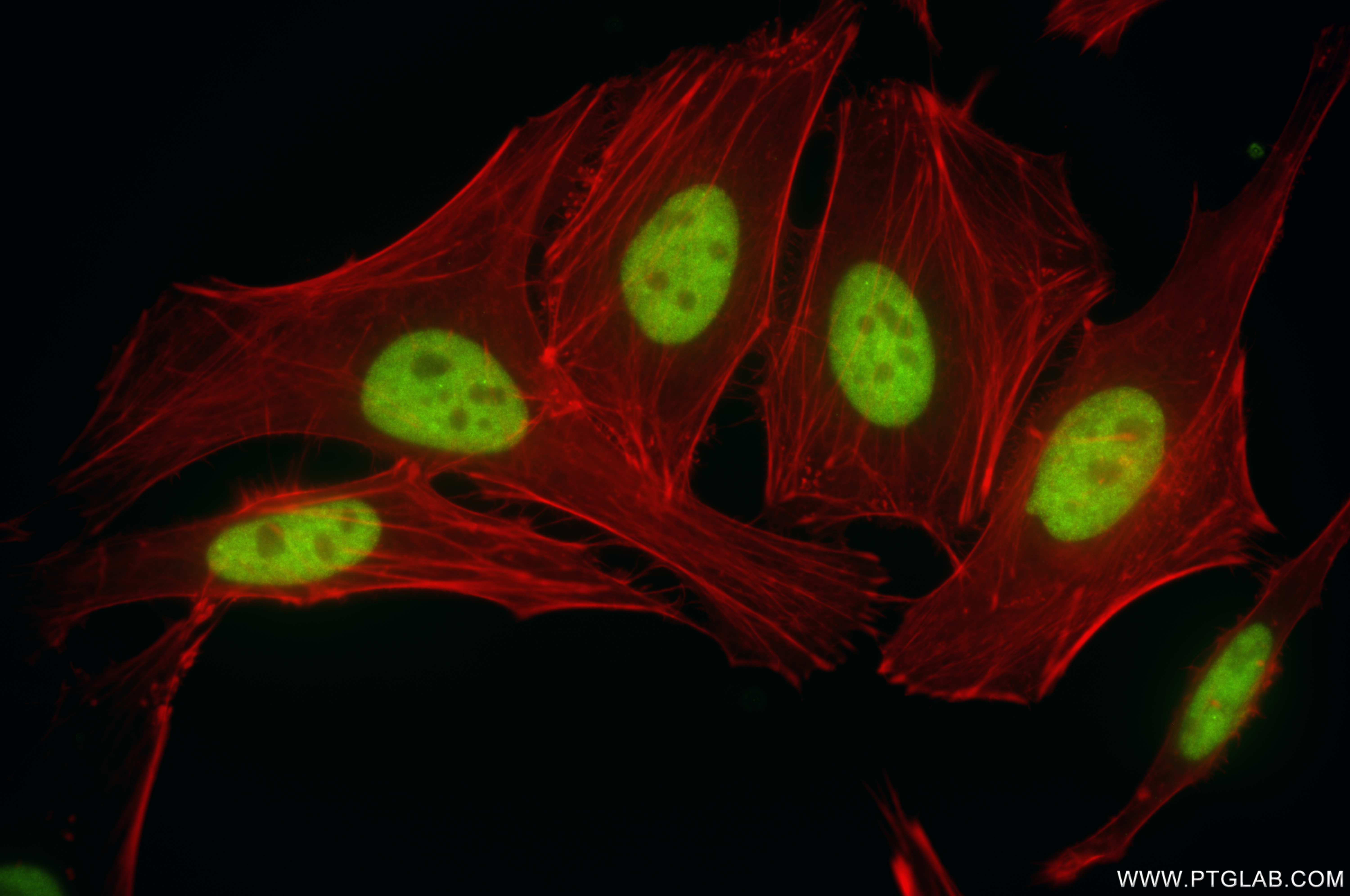 IF Staining of HeLa using 85945-1-RR (same clone as 85945-1-PBS)