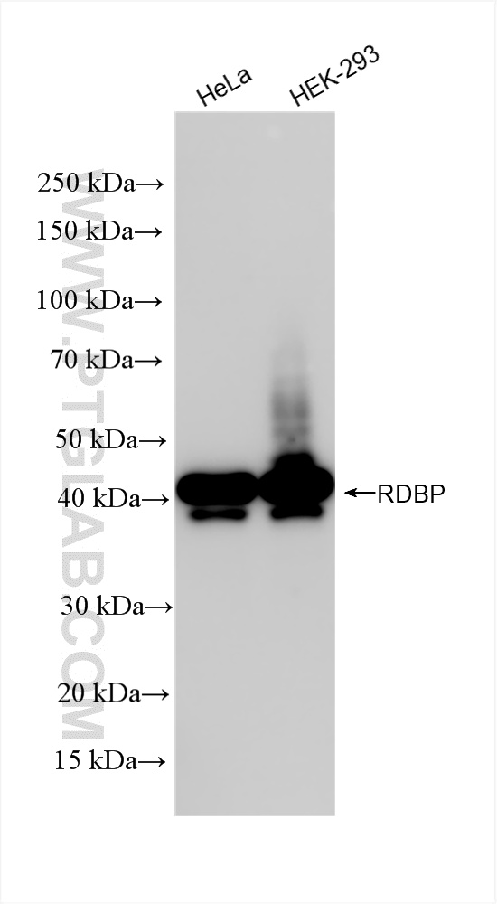 WB analysis using 85945-1-RR (same clone as 85945-1-PBS)