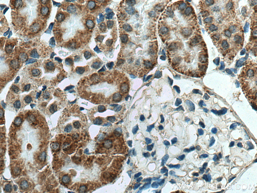 IHC staining of mouse kidney using 14644-1-AP