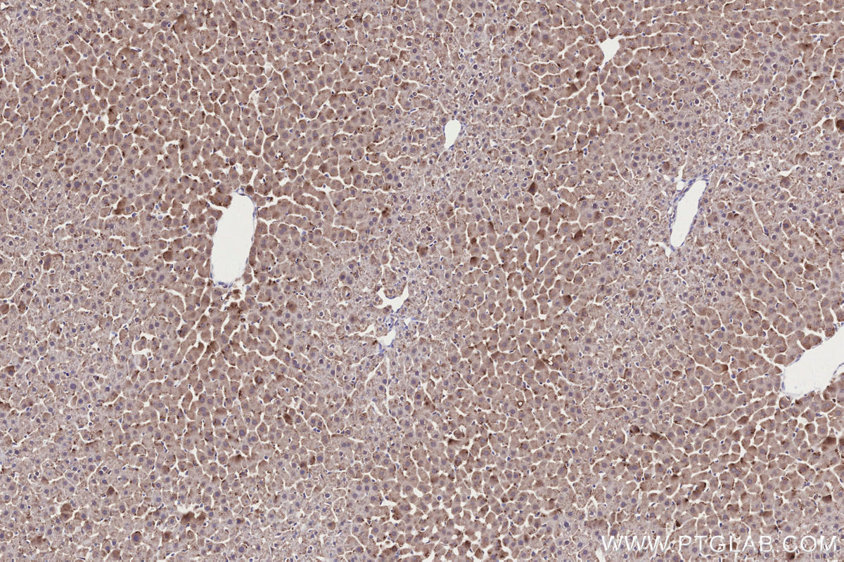 IHC staining of rat liver using 14644-1-AP