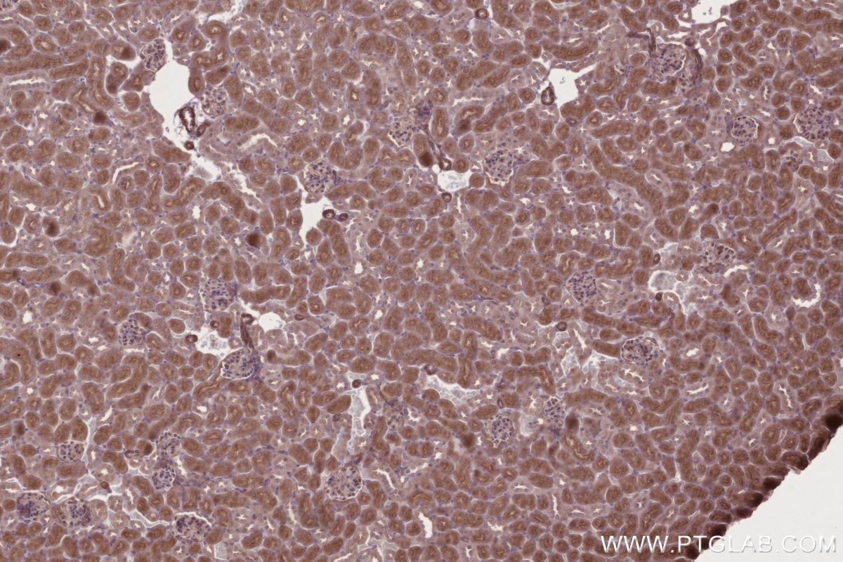 IHC staining of mouse kidney using 11077-1-AP