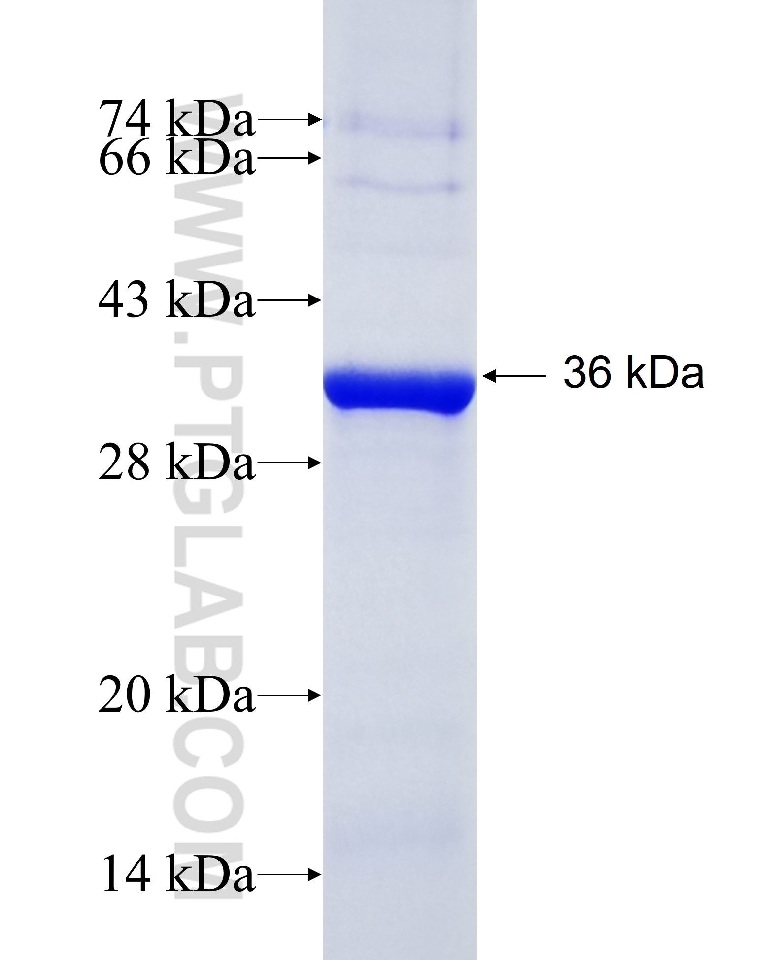 RDH12 fusion protein Ag28678 SDS-PAGE RDH12 fusion protein Ag28678 SDS-PAGE
