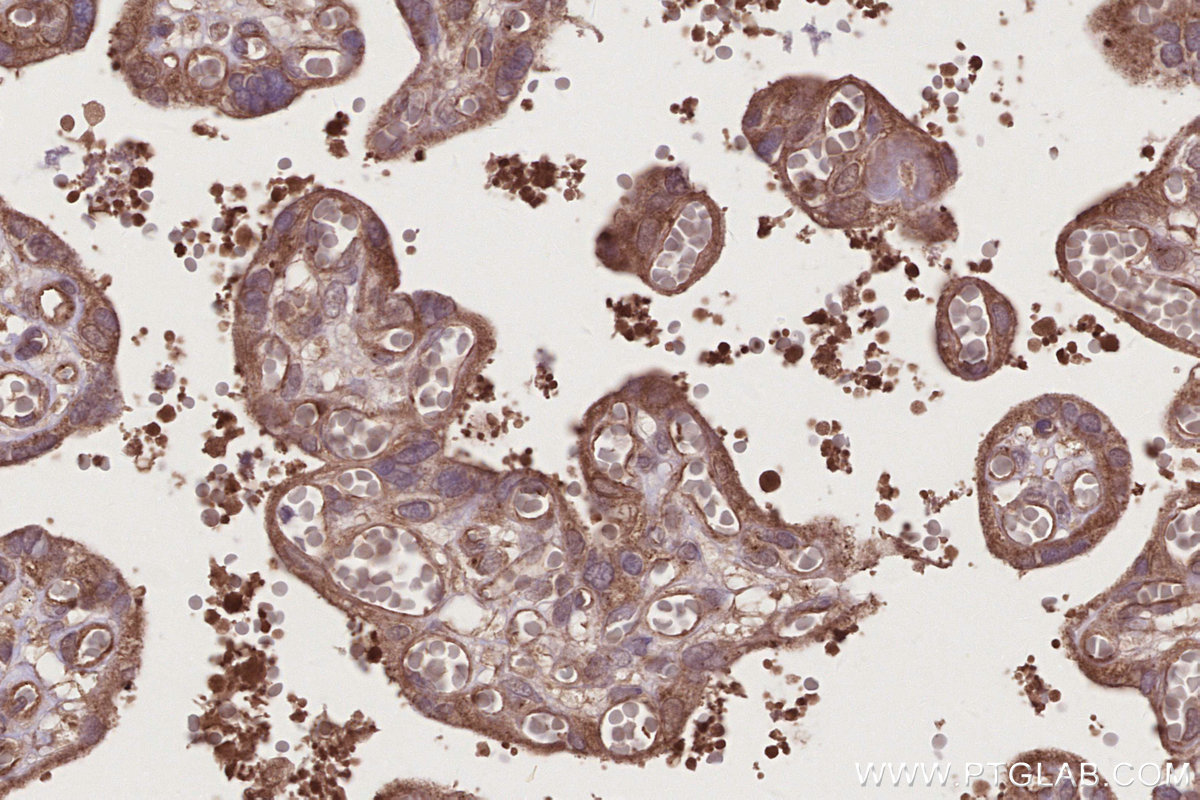 IHC staining of human placenta using 13140-1-AP IHC staining of human placenta using 13140-1-AP