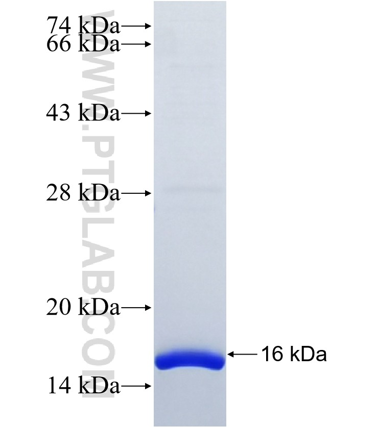 RDH8 fusion protein Ag19042 SDS-PAGE